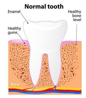 Diagram of normal tooth