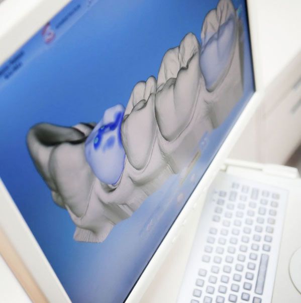 computer dental rendering