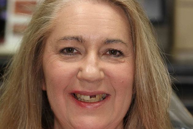 Woman missing a front tooth