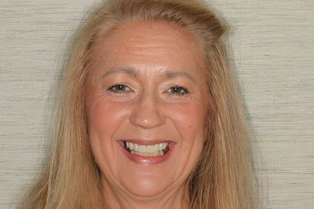 Woman with her front tooth restored