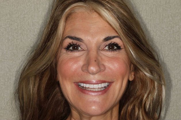 after cosmetic dentistry