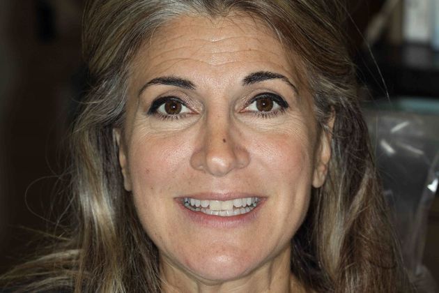 before cosmetic dentistry